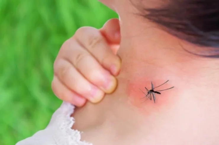Dengue