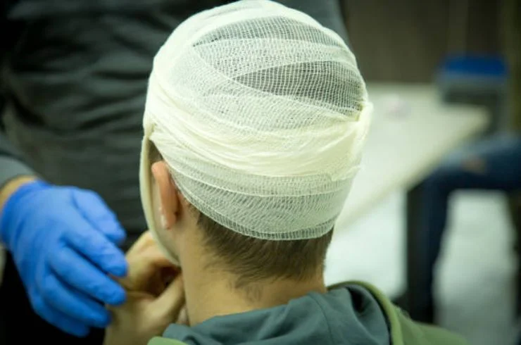 Head Injuries