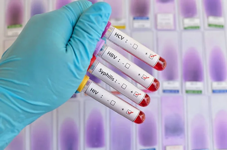 HIV