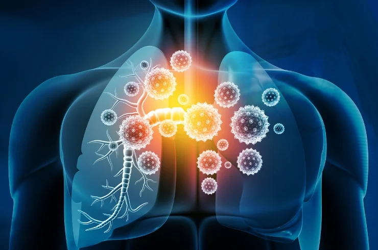 Lung Problems